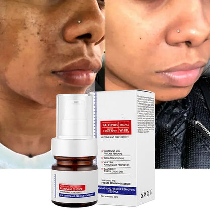 ⚡5-second brightening rescue: Dark spots disappear, blemishes fade, and skin becomes radiant! Vitamin C Whitening Freckles ESSENCE